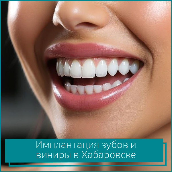 имплантация зубов и виниры в Хабаровске