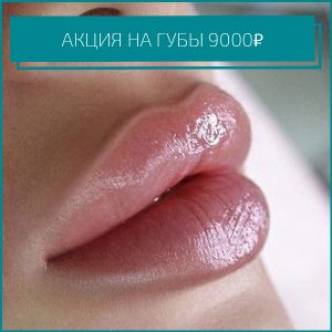 Увеличение губ по акции в Хабаровске